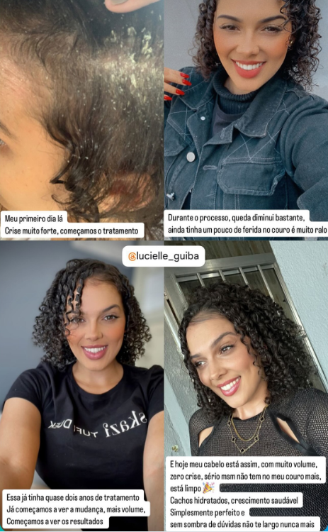 Depoimento 1